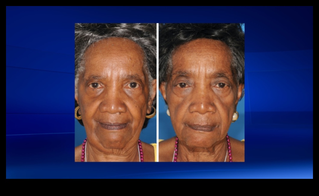 Ο αντίκτυπος του καπνίσματος στο δέρμα σας: Ελαχιστοποίηση της βλάβης μέσω της περιποίησης του δέρματος